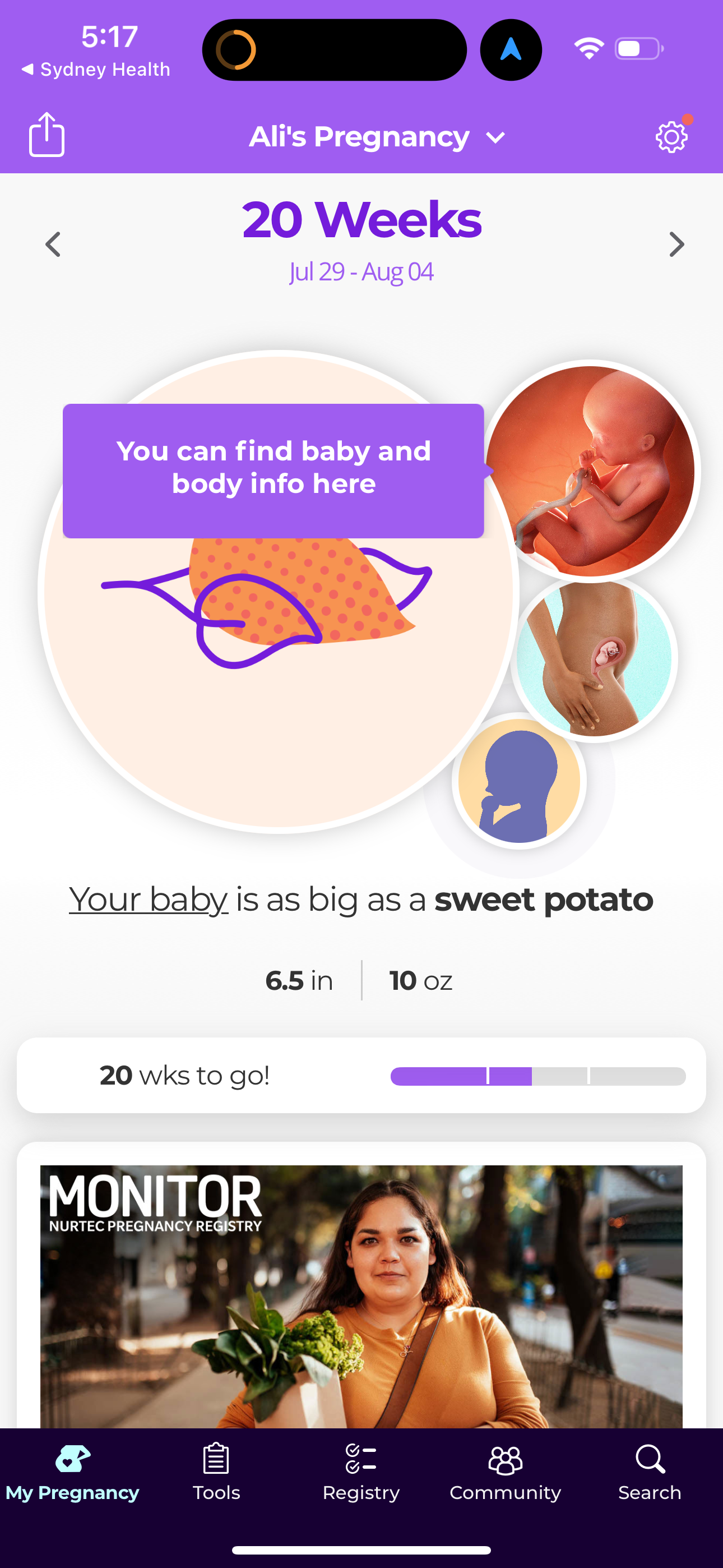 what-to-expect app screenshot 23