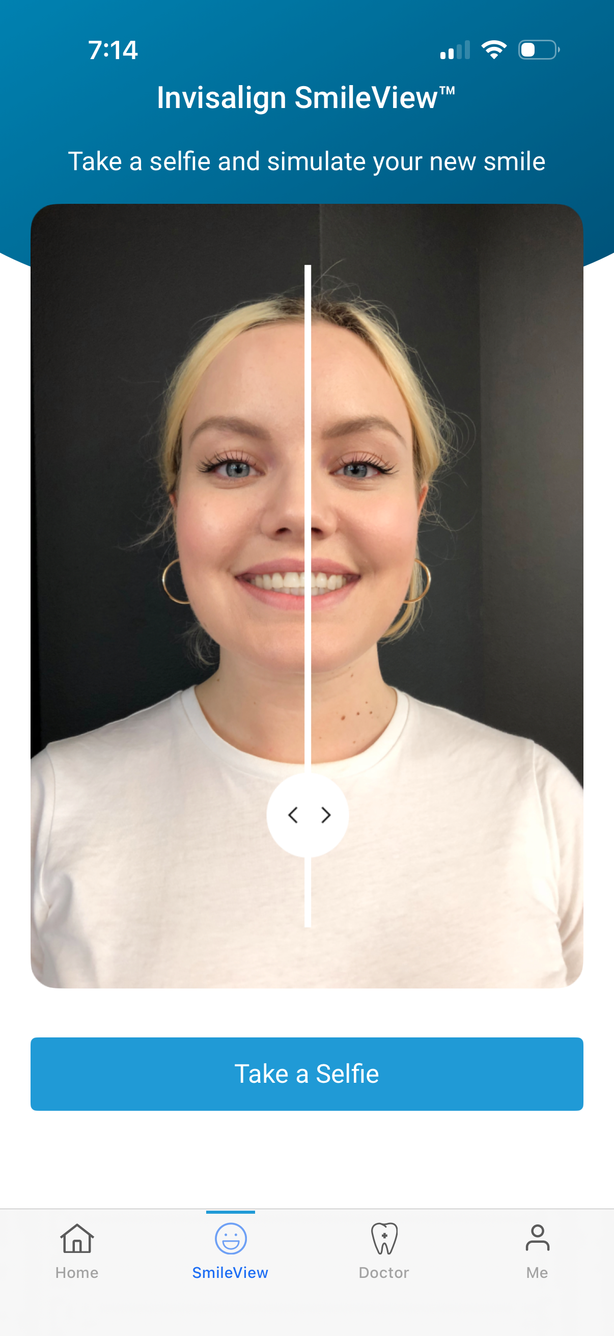 my-invsialign app screenshot 8