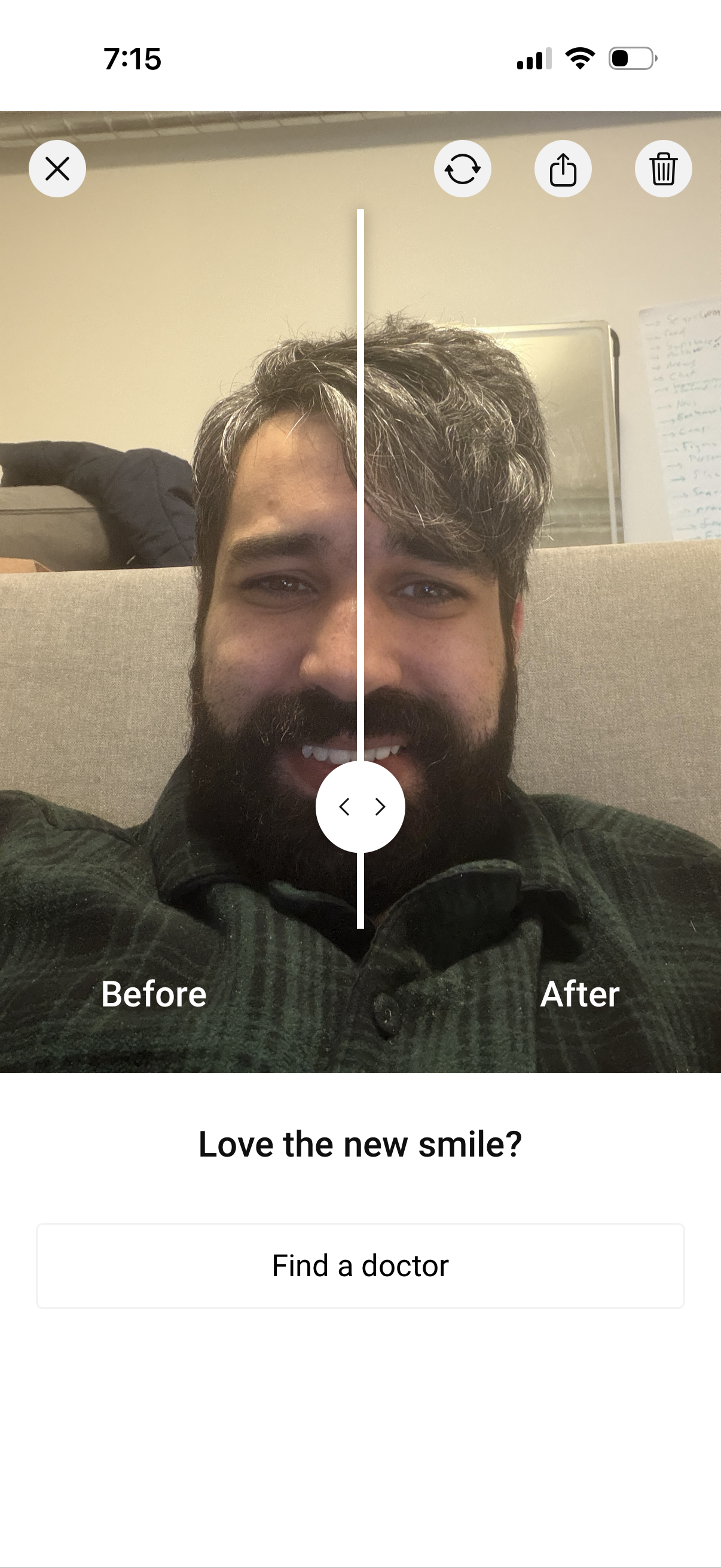 my-invsialign app screenshot 4