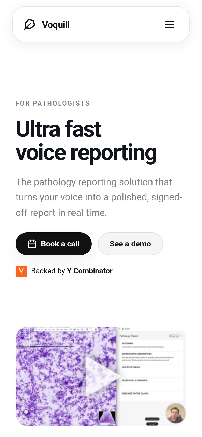 Mobile web annotations on the mobile capture